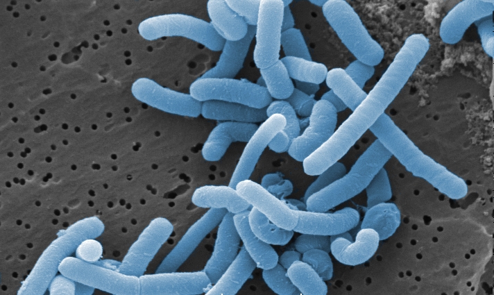 Bakterie Lactobacillus paracasei w mikroskopie elektronowym